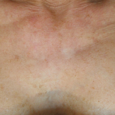 Before and After website thc (1)-3