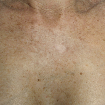 Before and After website thc-3