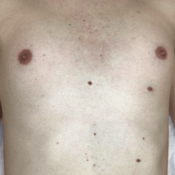 Before and After website thc-Aug-17-2024-02-03-38-8847-PM