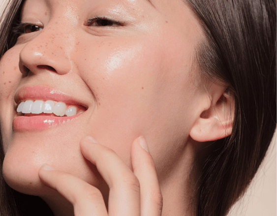 cosmelan melasma treatment in Bristol