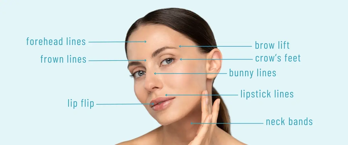 botox in bristol