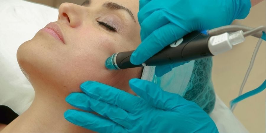 hydrafacial in bristol
