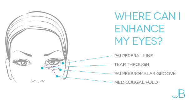 eye-bag-removal-bristol