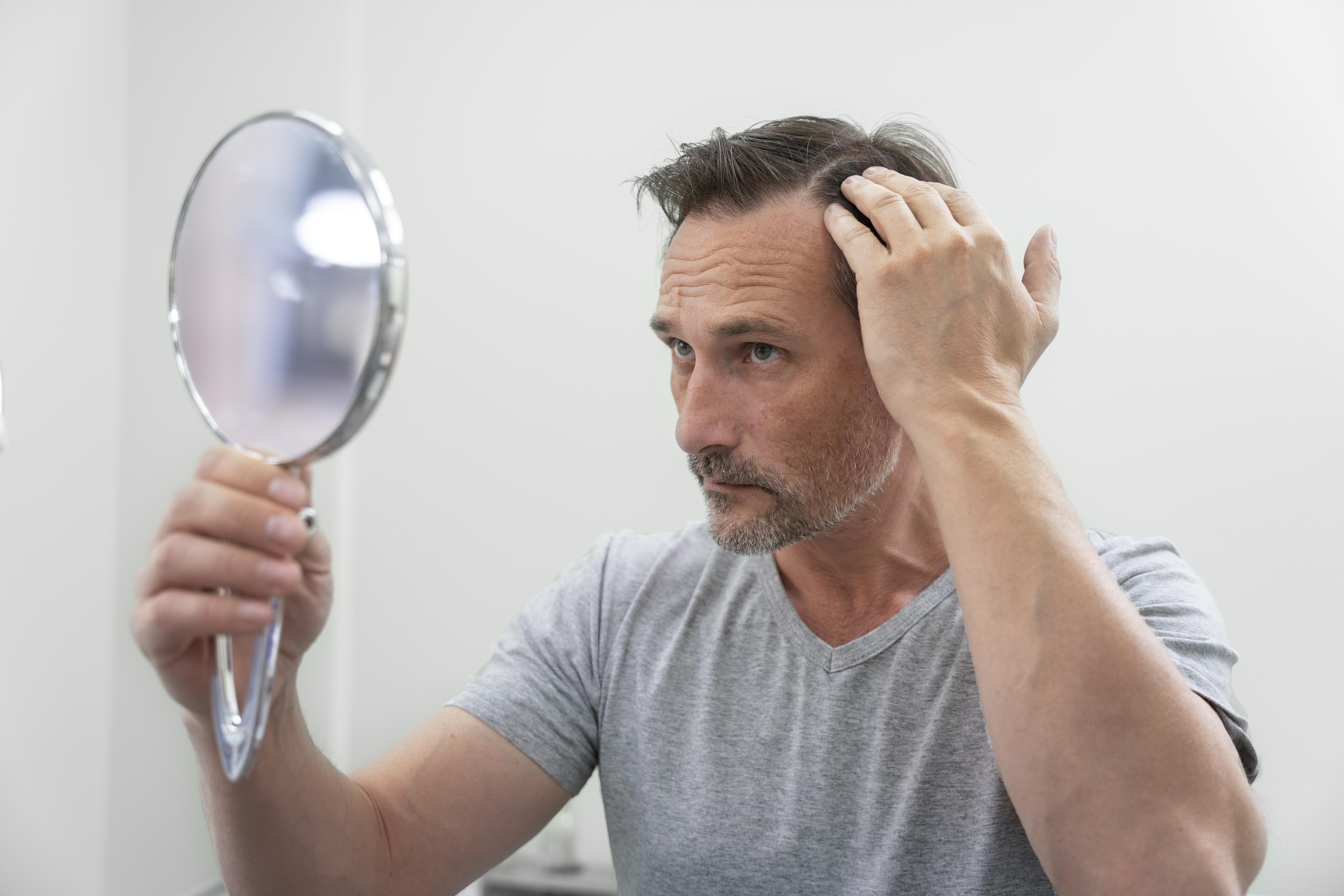 man-getting-hair-loss-treatment