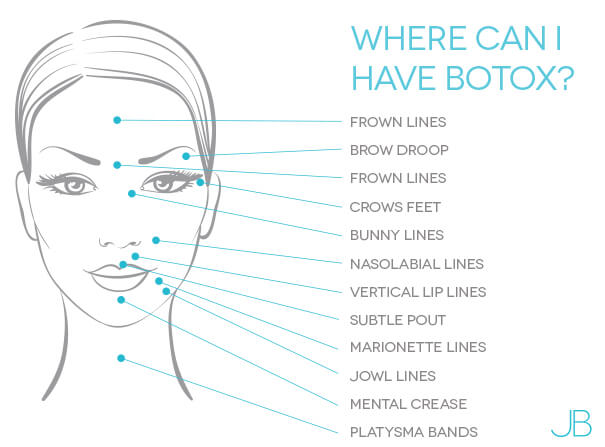 where-can-i-have-botox-bristol